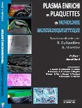 Plasma enrichi en plaquettes en pathologie musculosquelettique