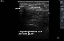 Commentaires et annotation des images Commentaires et annotation des images
