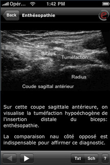 Musculoskeletal Ultrasound pour iphone