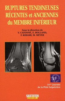 Ruptures tendineuses récentes et anciennes du membre inférieur