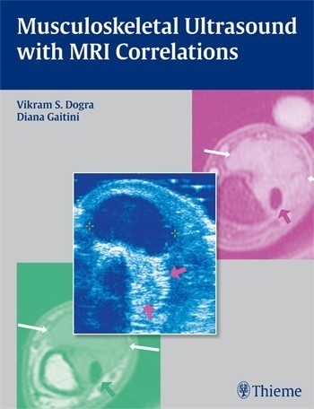 Musculoskeletal Ultrasound with MRI Correlations Musculoskeletal Ultrasound with MRI Correlations