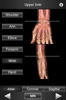 Monster Anatomy – Upper Limb