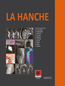 La hanche La hanche