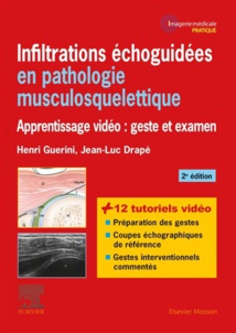 Infiltrations échoguidées en pathologie musculosquelettique Infiltrations échoguidées en pathologie musculosquelettique