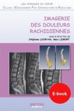 Imagerie des Douleurs Rachidiennes Imagerie des Douleurs Rachidiennes