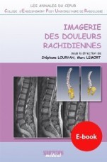 Imagerie des Douleurs Rachidiennes