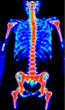 Le PET SCAN Le PET SCAN