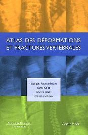 Atlas des déformations et fractures vertébrales Atlas des déformations et fractures vertébrales