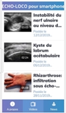 ECHO-LOCO pour smartphone ECHO-LOCO pour smartphone