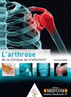 L'arthrose