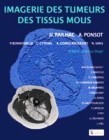 Imagerie des tumeurs des tissus mous