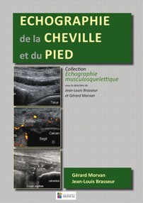 Echographie de la cheville et du pied Echographie de la cheville et du pied