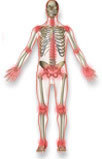 Arthrolink.com Arthrolink.com