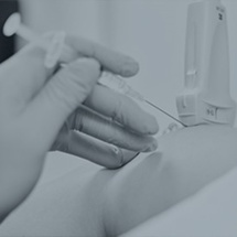 Les infiltrations écho guidées en pratique: 3 par échographe Les infiltrations écho guidées en pratique: 3 par échographe