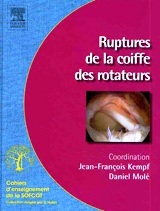 Ruptures de la coiffe des rotateurs