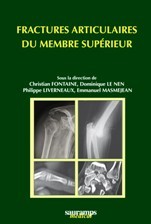 Fractures articulaires du membre supérieur Fractures articulaires du membre supérieur