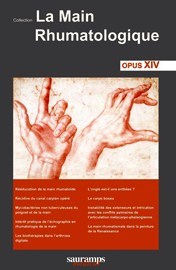 La main rhumatologique La main rhumatologique