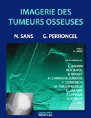 Imagerie des tumeurs osseuses