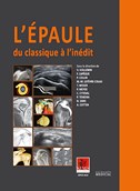 L'épaule