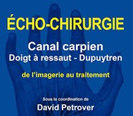 Echo-chirurgie: canal carpien, doigt à ressaut, Dupuytrens