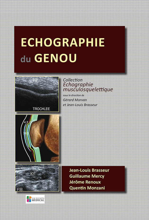 Echographie du genou