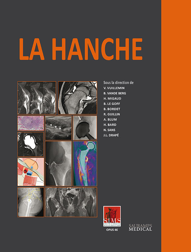 La hanche