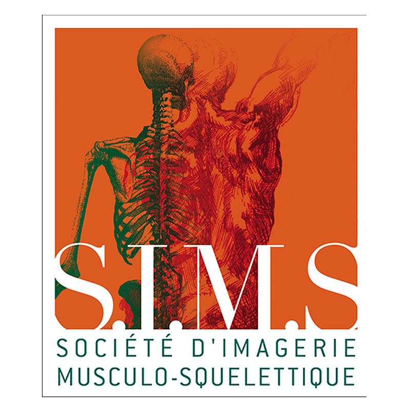 Muscles et Fascias
