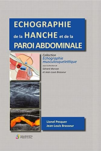 ECHOGRAPHIE DE LA HANCHE ET DE LA PAROI ABDOMINALE