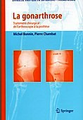Gonarthorse - Traitement chirurgical