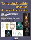 Tomoscintigraphie osseuse de la cheville et du pied