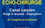 Echo-chirurgie: canal carpien, doigt à ressaut, Dupuytrens