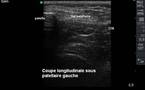 Commentaires et annotation des images