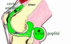 Kyste arthrosynovial de Baker : ce que doit savoir l’échographiste …