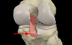 Anatomy Knee Quiz