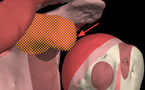 Anatomy Shoulder Quiz
