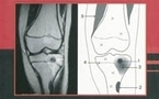 Pathologie articulaire et péri-articulaire des membres