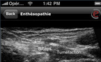 Musculoskeletal Ultrasound pour iphone