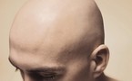 Le signe de la tête chauve