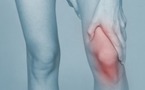 Lésions ostéo-chondrales fémoro-patellaires