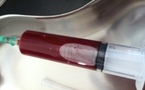 Ponction liquidienne du genou