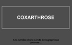 Coxarthrose