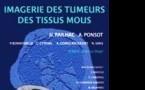 Imagerie des tumeurs des tissus mous