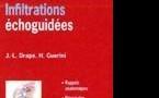 Infiltrations écho-guidées