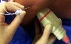 Anesthésie loco-régionale facile aux urgences