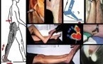 Brièveté des gastrocnemiens