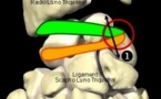 La sangle ligamentaire dorsale du poignet