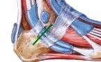 Ligament calcanéo-fibulaire