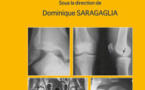 Traumatologie à l'usage de l'urgentiste: 3eme édition