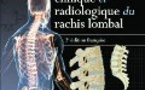 Anatomie clinique et radiologique du rachis lombal