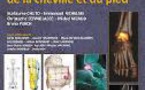 Tomoscintigraphie osseuse de la cheville et du pied